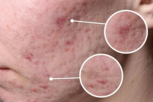 斑点|身体频繁出现这6个表现,或是疾病即将到来,需及时调理