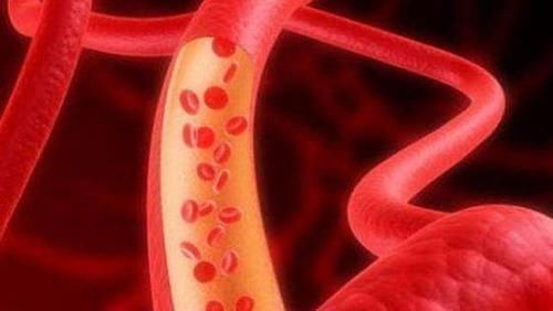 堵塞|中医直言血管一堵，易生百病，常吃5种蔬菜血管不再堵，别错过