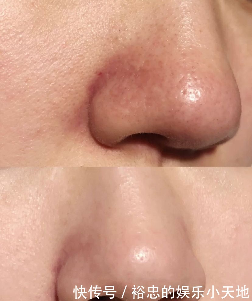 肌肤|初夏变美关键在护肤,4个实用小技巧,让你轻松拥有好肌肤