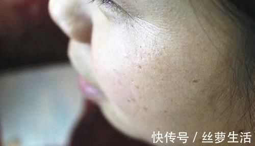 骨质疏松|为啥女人进入更年期后,都会变“丑”?教你三招,或能重返年轻
