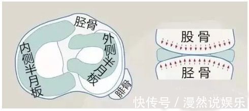 事儿|运动后，你的半月板还好么关于半月板的这点儿事儿！