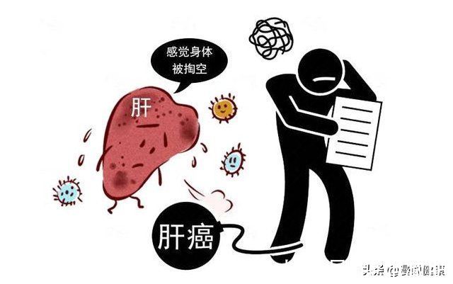 生活习惯|我国更多的人被肝癌”盯上“！预防肝癌不难，做好4点最关键