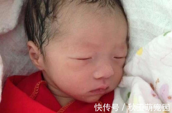 医生|孕妈预产期过了3周才去医院,医生剖腹后差点熏晕,无知差点害人