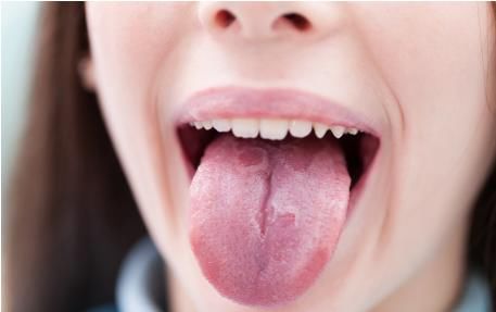 哈欠|血管“清洁工”已发现！不是芹菜，你若常吃，血管或会畅通无阻碍