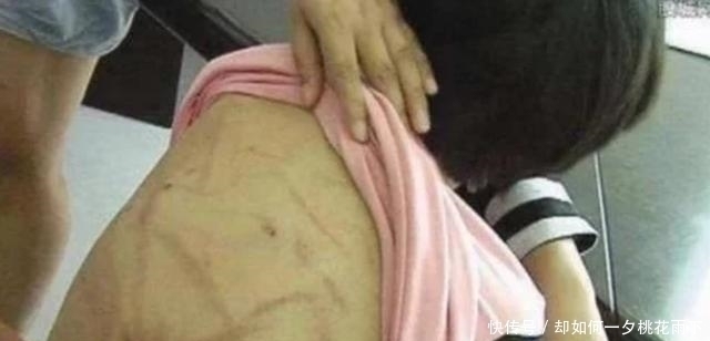 dn7岁女儿半夜发高烧,嘴里一直说书包破了,宝妈打开后情绪失控