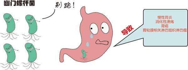 胃黏膜|如何知道自己感染了幽门螺杆菌？
