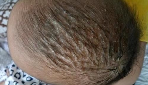 高鼻梁|不要对月子里新生儿做9件事,家长早知道早避坑,别影响娃的发育