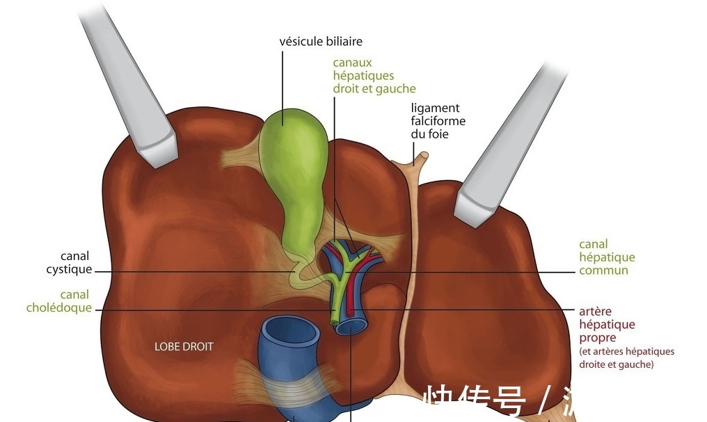 消炎法|1/6的癌症是由炎症引起，若学会身体“消炎法”，或会远离疾病