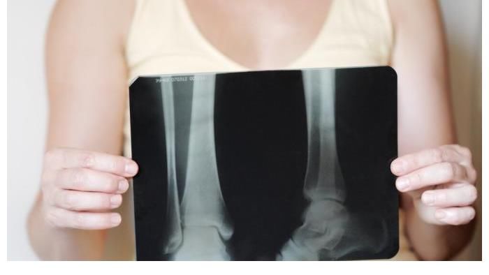 餐桌|复旦教授曝光:1种蔬菜吃多或会降低骨密度,赶紧从餐桌撤下