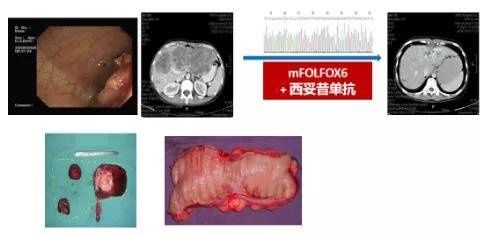 大团圆前又得癌！影视剧中的那些癌症“套路”，你看懂了吗？|健康过年 | 手术