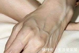 指甲|肝脏不好，手上会发出4个信号，若没有，说明肝脏还算健康
