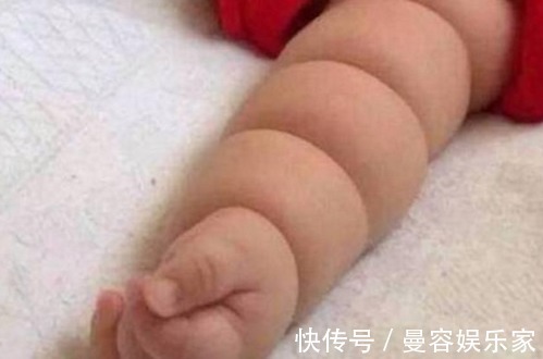 纤维带|宝妈发现孩子身上长一圈圈的,都不知道是啥,医生检查后泣不成声