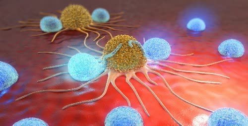 结肠癌|会癌变的肠息肉越来越多,1个习惯是凶手!医生奉劝赶快远离