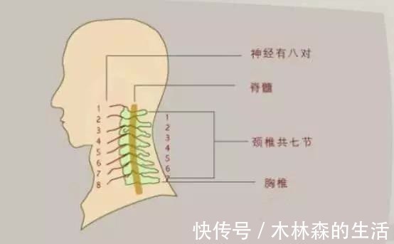 颈椎病|如何摆脱颈椎病疼痛？颈椎病的综合康复治疗，你需要知道！