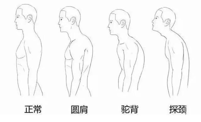 心血管疾病|变矮2厘米，早亡风险增七成