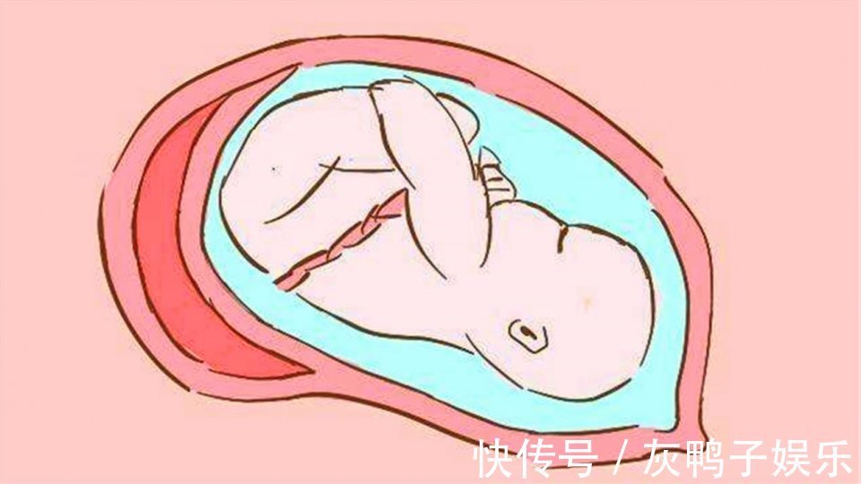 医生|生下“带壳宝宝”,产妇着急落泪,医生却高兴祝贺是好事