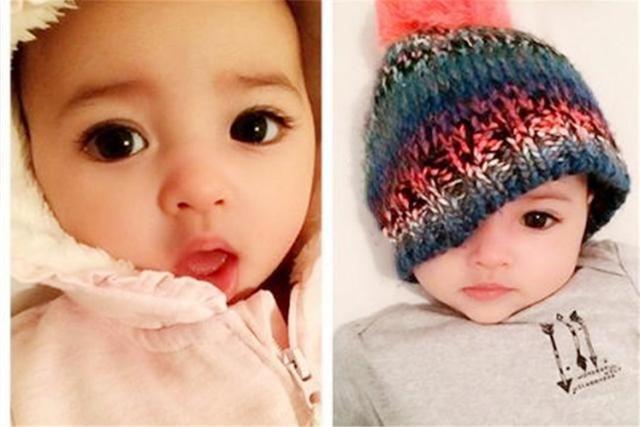 肤色|出生后美貌迷倒众人,被评为“最美宝宝”的孩子,如今她长成这样