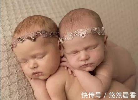 双胞胎|孕妇摔倒导致双胞胎死在腹中,孕妇抱着不松手,之后奇迹发生了