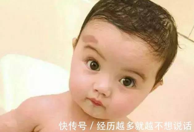 维产科专家要想宝宝不长胎记,孕期避开三件事就OK,别不当回事