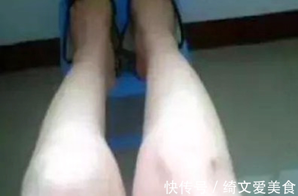 医生|多走路、多喝水……你以为在养生,但医生告诉你:其实在折寿!