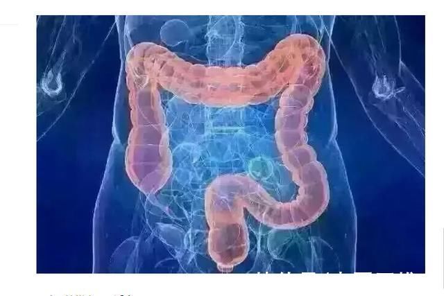 结肠癌|女子服用2年肠清茶肠子变黑 结肠黑变病或将增加罹患结肠癌风险