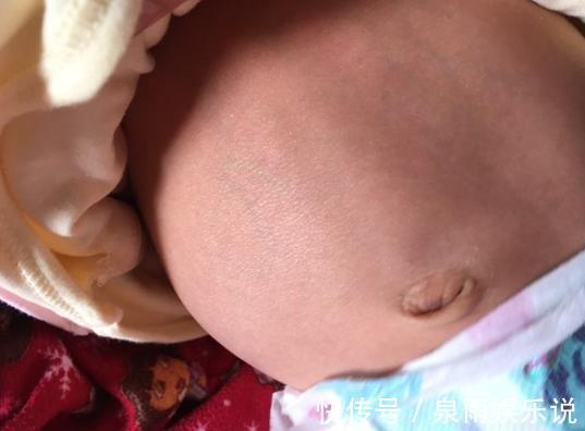 胃部|孩子过度积食,胃部鼓胀胀,补充这两物,胃部残留一扫而空