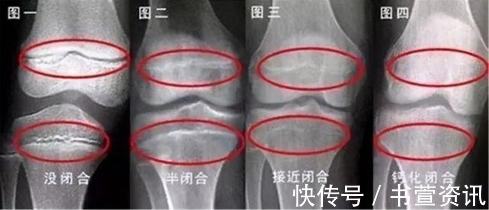 定格|当男孩出现这些特征,暗示到了长高“天花板”,和年龄关系不大