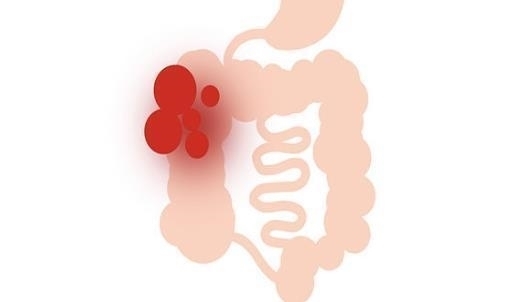 便秘|大便拉完“意犹未尽”,总感觉没排干净多半是3个因素作祟