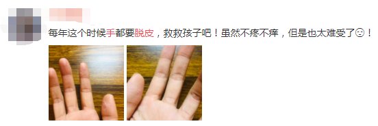 掌跖脓疱病|宝，听说你最近在脱皮？脱什么皮？
