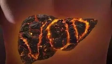 肝火|心火、胃火、肝火、肺火、肾火,一个4味药方,五脏之火通通扑掉