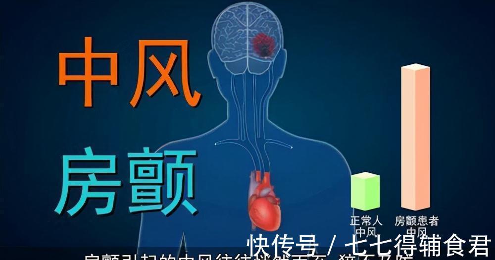 心房|预防房颤中风,丢掉阿司匹林!