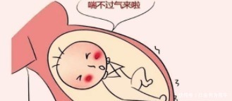 胎儿|孕期这些胎动极不正常, 若疏忽大意, 可能酿早产或流产!