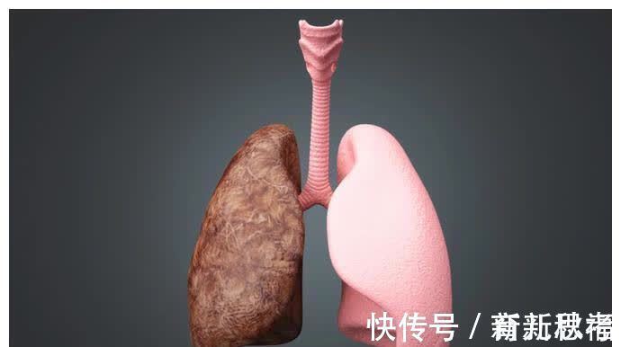 肿瘤|癌症在发作前2年征兆,放到圈子很多人会感激你一辈子!