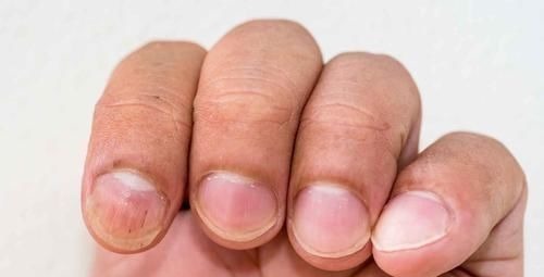 黑线|他才是最强的奥特曼？能吸收奥特之王的力量，新生代称他为神