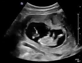 妈妈|胎宝也会肚子饿,孕妈收到这三种“信号”,说明需要补充能量了