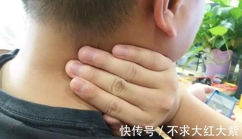 甲状腺|身上突然摸到肿块,就一定是得癌了?不同位置或暗示不同问题