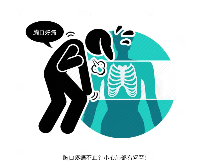 咳嗽|肺癌并不是毫无预兆,这3个症状反复找上自己,或是癌变的信号