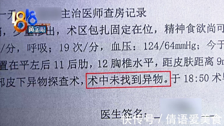 探头 吸脂术探头留在姑娘体内,院方两次手术都没取出