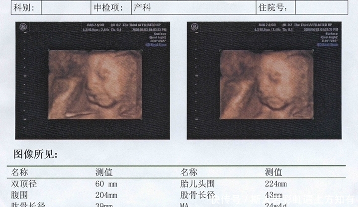 孕妇|确定怀孕后，第一次产检是在什么时候？超过这个时间，就晚了