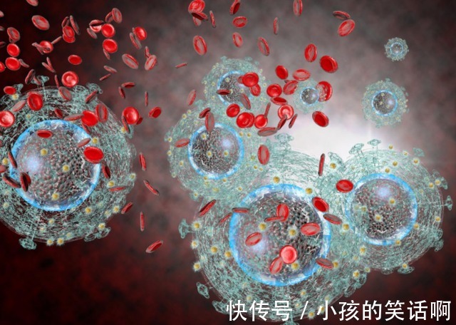 癌症|从“炎症”到“癌症”需要多久?提醒:3种炎症建议尽早治疗