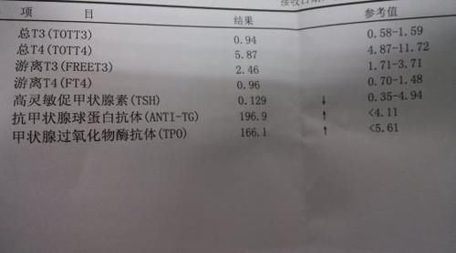  分泌|甲状腺是“熬”不起的，教你4招，远离甲状腺疾病