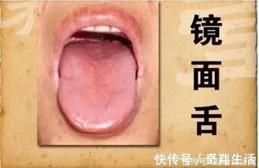 脱胎换骨|二陈丸一个能让身体“脱胎换骨”的千年古方,这个夏天很需要