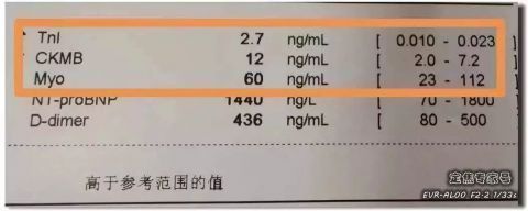 心肌|从“上火”到心肌死亡仅5天！牢记16字，必要时能救命！