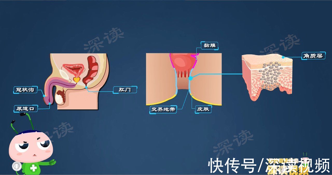 尖锐湿疣|明明没出轨，为啥染上尖锐湿疣？有哪些你不知道的事会招惹HPV？