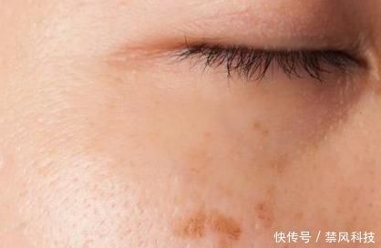 肝癌怎么越来越多,医生:有一种水果比喝酒更伤肝,不妨看一看