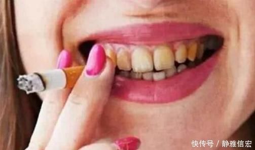 牙黄|牙齿越刷越黄！是牙膏的原因？三种应对牙黄方法需掌握！