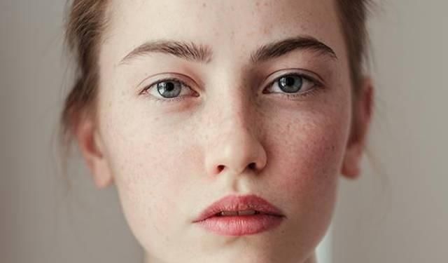 红霉素软膏加一物敷脸,15天美白肌肤淡化色斑,赶紧去备上一支