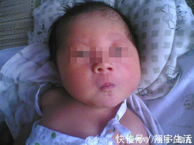 宝宝|新生儿双脚大面积蜕皮,宝妈火急火燎跑医院,医生看到却很淡定