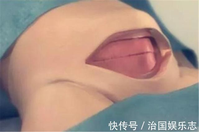 宝妈|九张剖腹产手术全过程图片,那些说生孩子容易的人好好看看