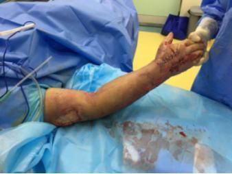 回事|手术中病人突然眼花，原来是这么回事